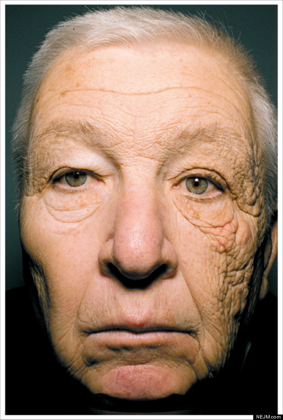 The startling effects of sun damage